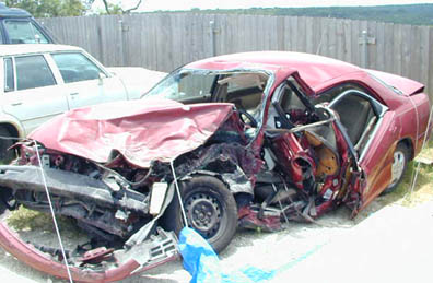 23 broken and fractured bones was in ICU for 11 days